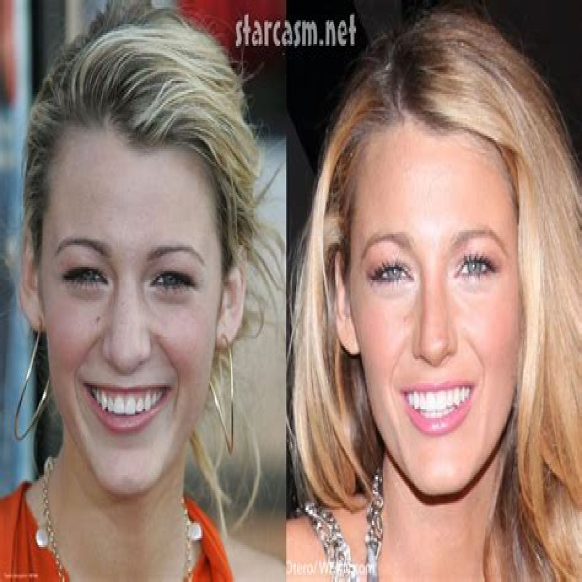   Blake Lively before and after the rumoured nose job she’s never admitted to    Thu 12 May 2022 14:06    Updated Thu 12 May 2022 14:57    Niamh Colclough    