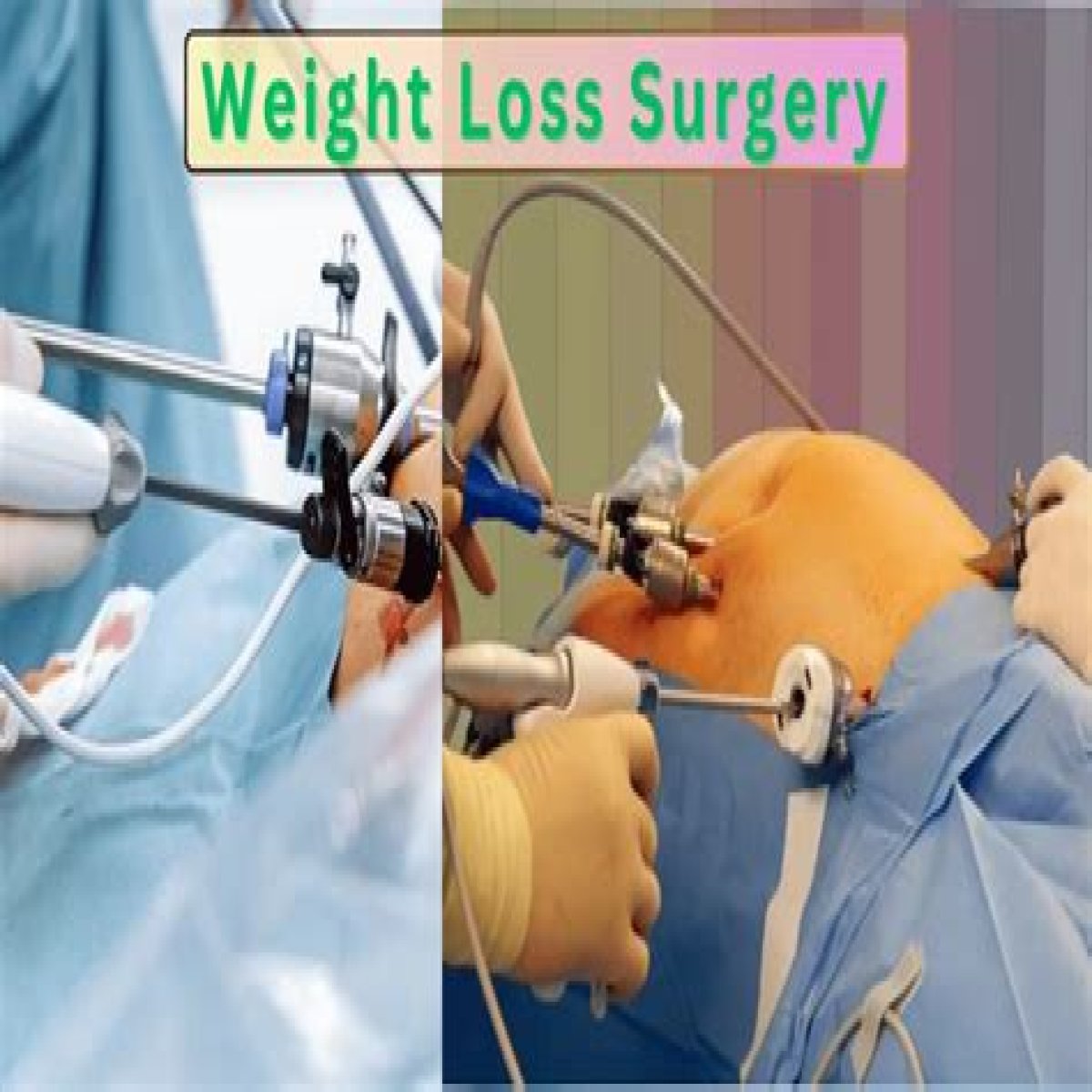 Discoveries Before Weight Loss Surgery