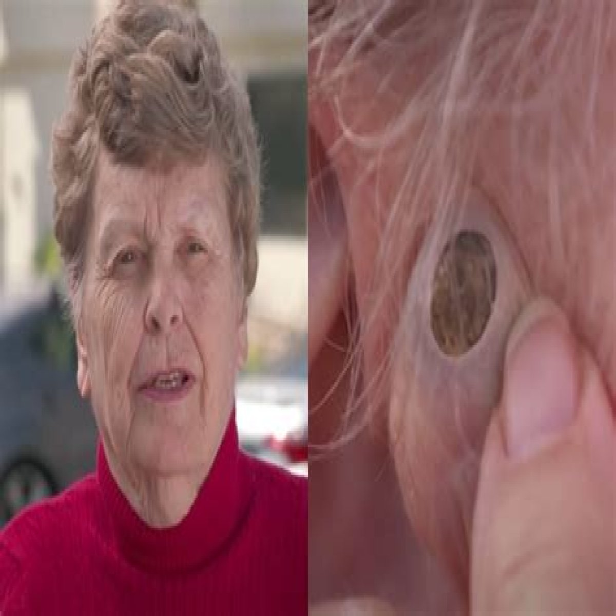   Dr Pimple Popper’s 2023 blackhead removals have fans begging for more    Fri 24 March 2023 20:00    Updated Sun 26 March 2023 12:40    Darcy Rafter    