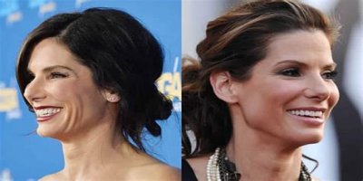 Has Sandra Bullock Had Plastic Surgery Inside?