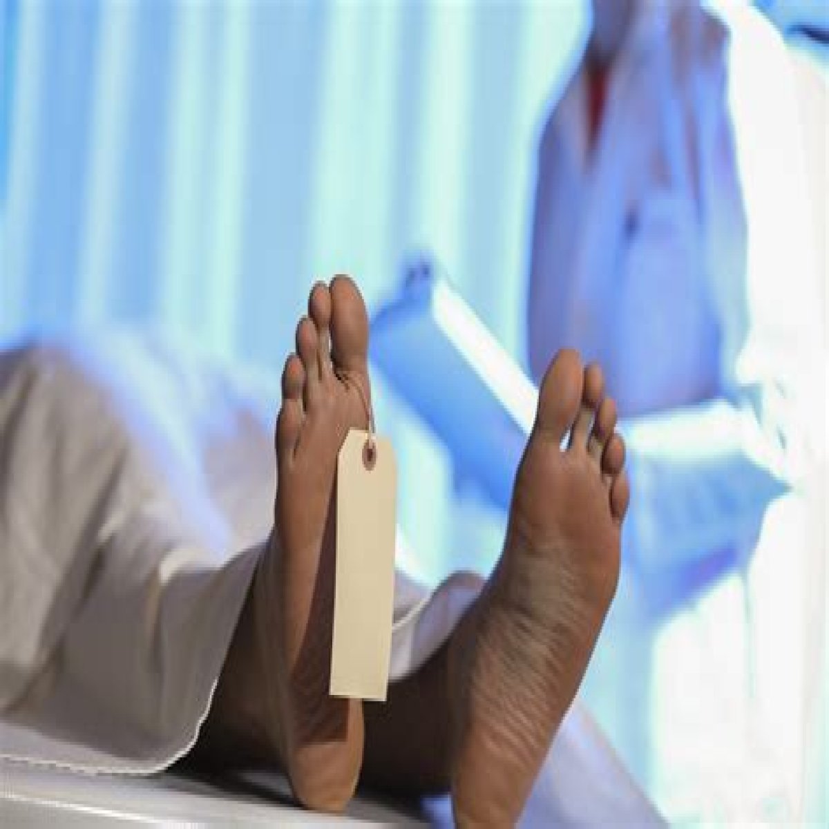 How Much Does The Average Autopsy Cost And Who Pays For It?