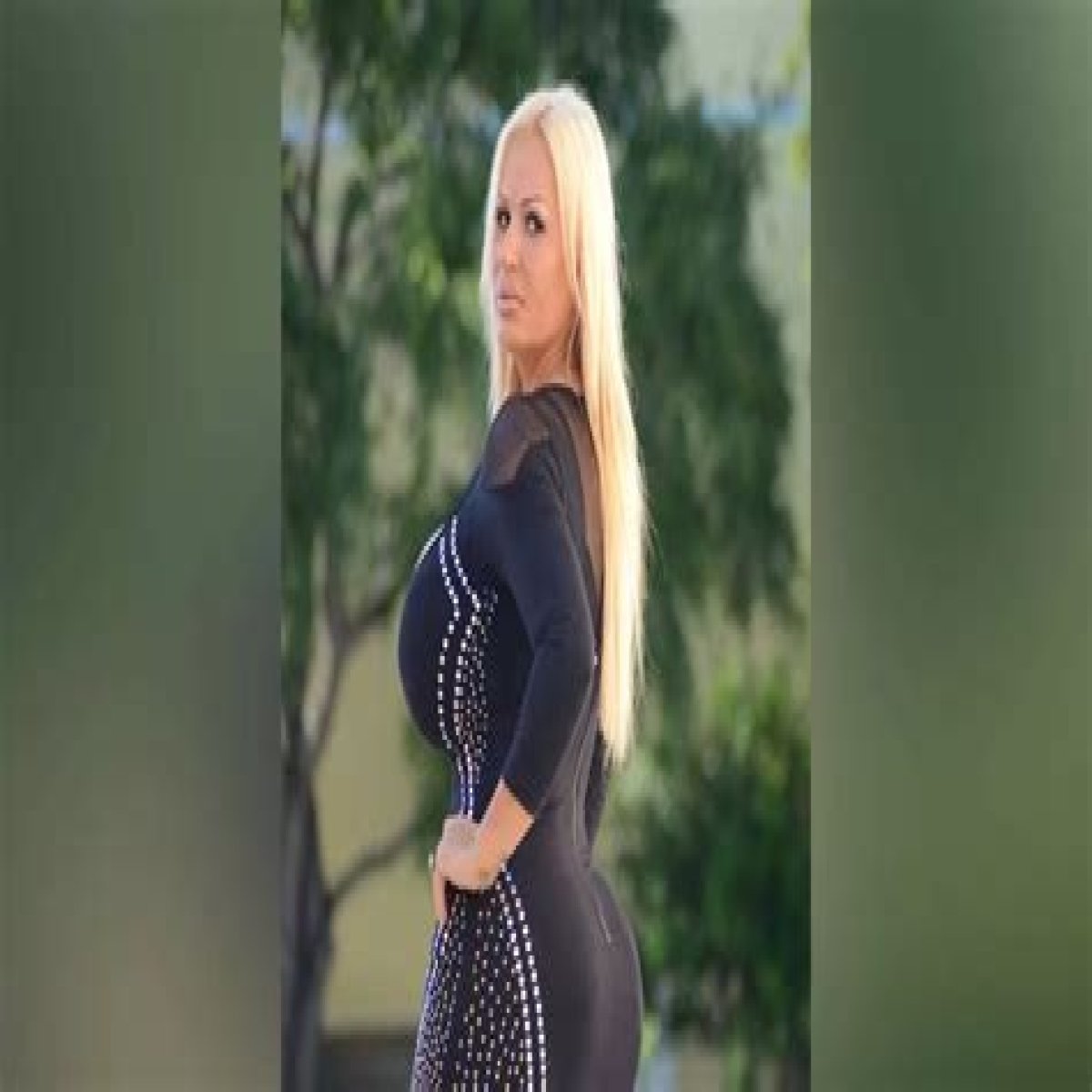 Lacey Wildd Plastic Surgery Before And After, Where Is She Now?