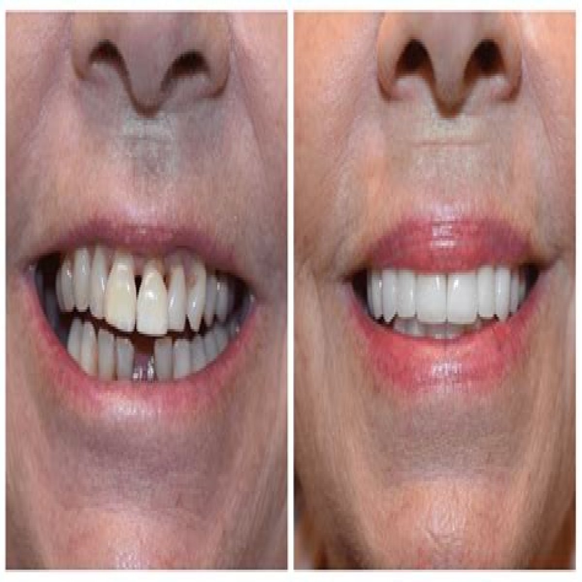 Uncovering The Journey Behind His Radiant Smile