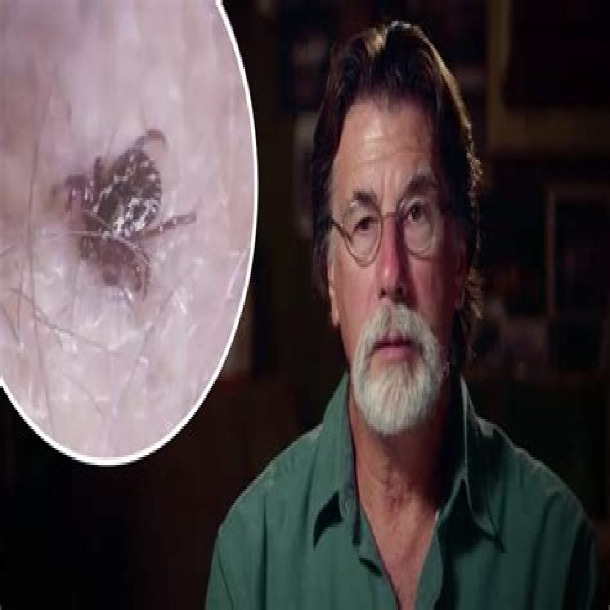 What Is Rick Lagina's Illness? Details On His Lyme Disease